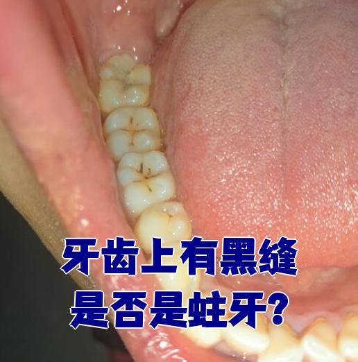 黑码是什么情况(黑码是什么意思是什么) 黑码是什么情况(黑码是什么意思是什么)
