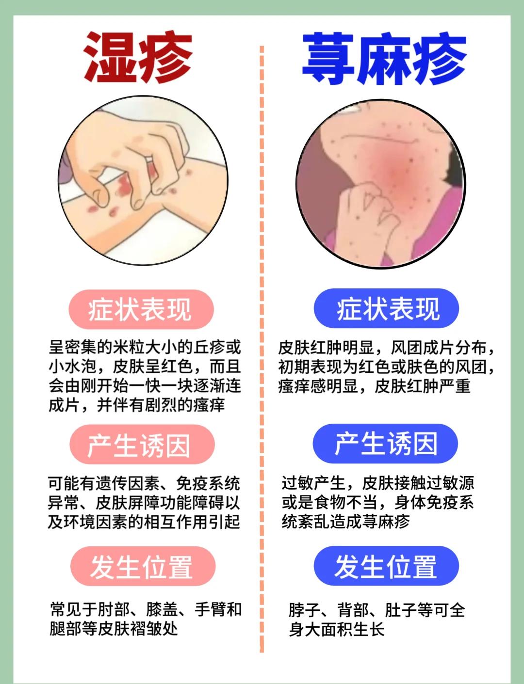 湿疹与热疹的区别图片(湿疹与热疹的区别图片宝宝)