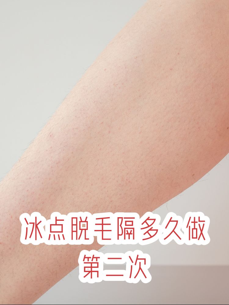 腋下脱毛方法(腋下脱毛有哪些方法?效果比较好) 腋下脱毛方法(腋下脱毛有哪些方法?效果比较好)