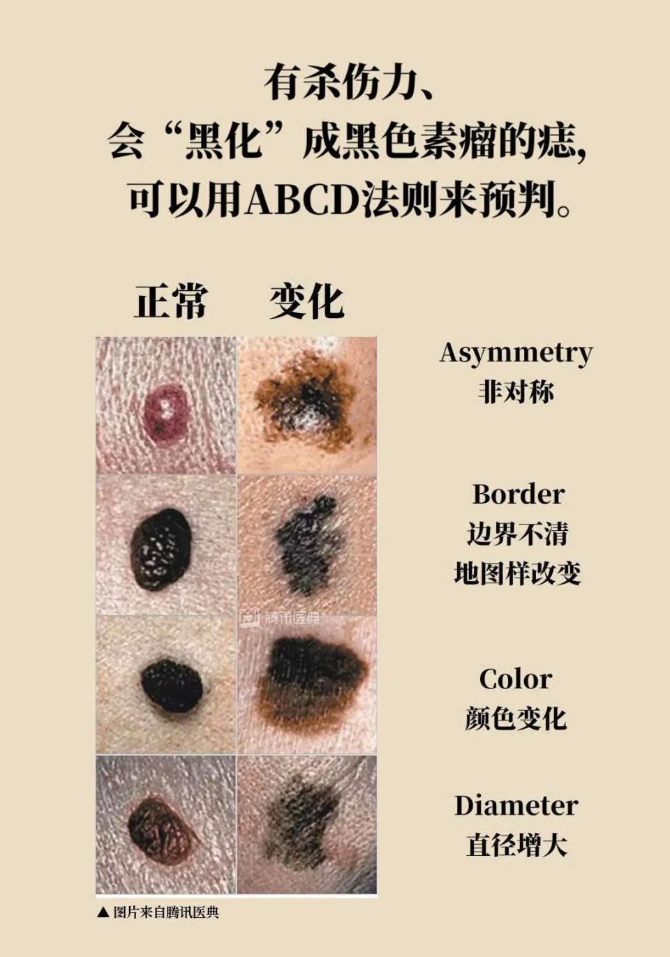 锁眉痣是好还是坏(锁眉痣是好还是坏的)