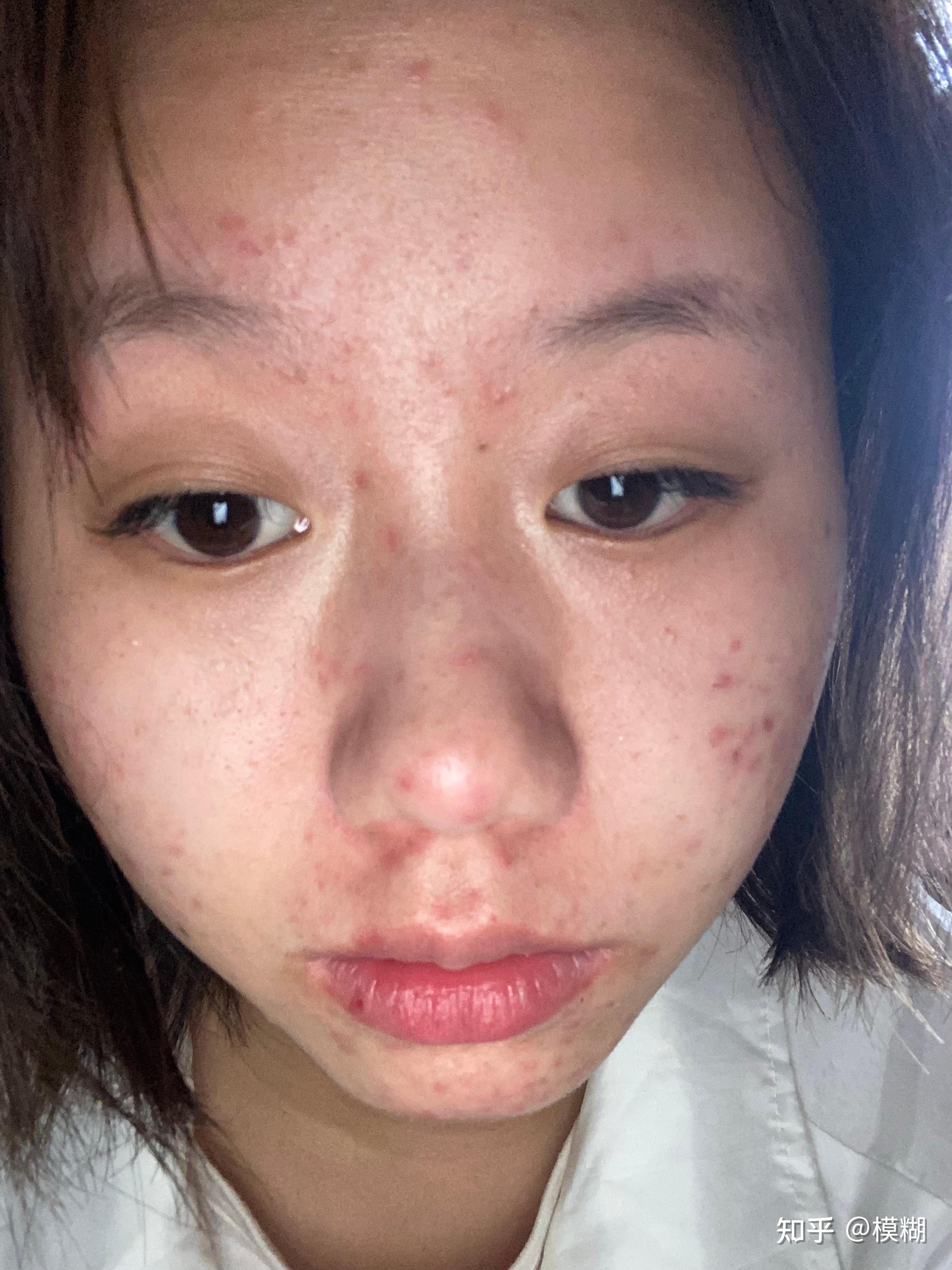 女生长得丑的标准图片(女生长得丑的标准图片大全)