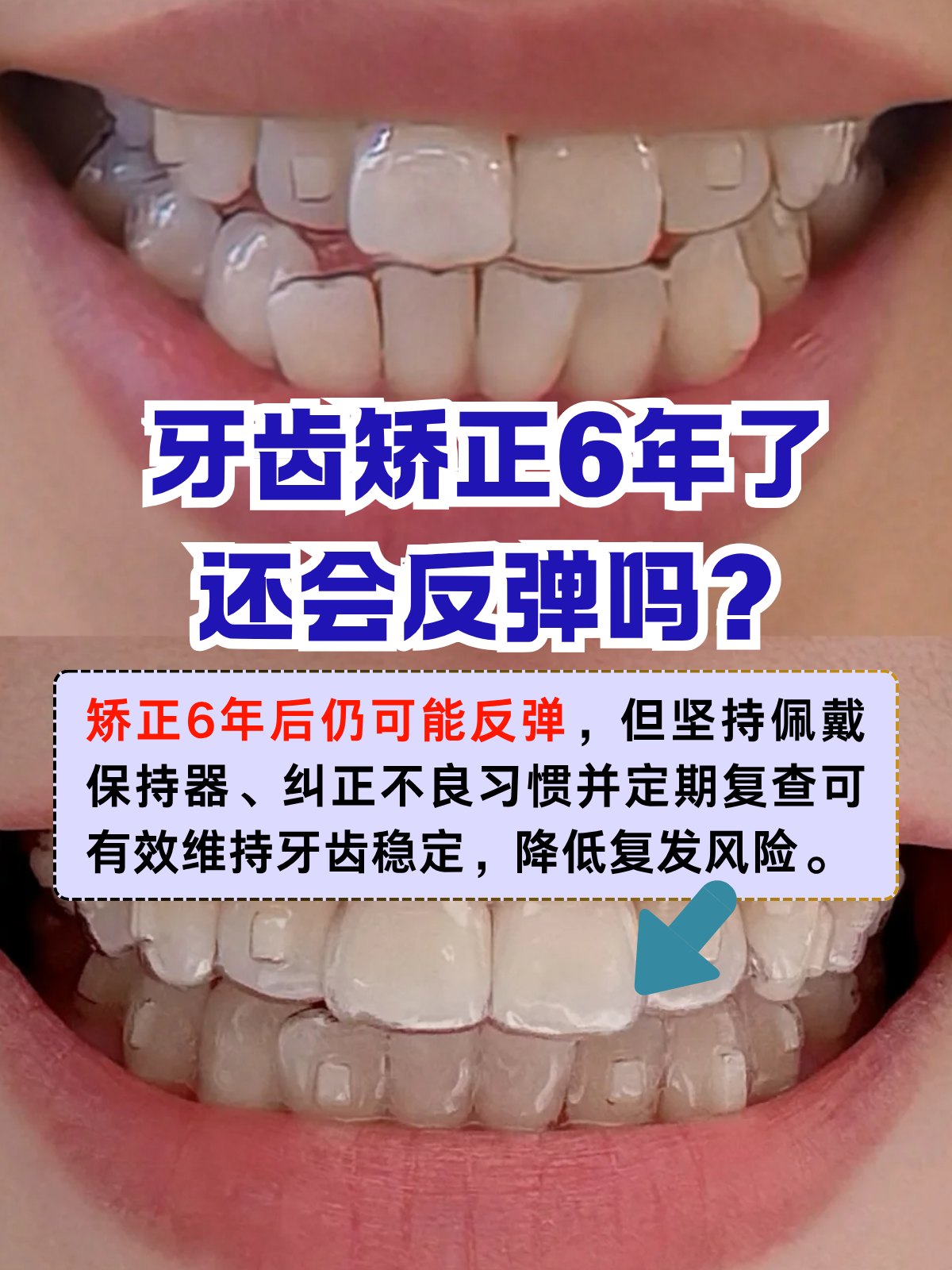 过往矫正(过往矫正也无妨)
