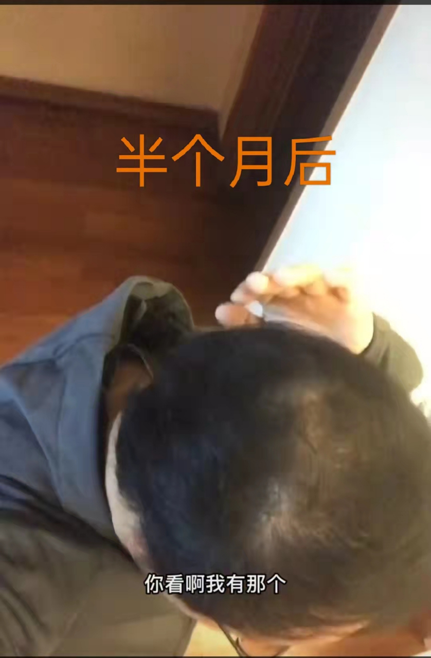 不用洗头膏洗头会长头发吗(不用洗发膏洗头对头发有影响吗) 不用洗头膏洗头会长头发吗(不用洗发膏洗头对头发有影响吗)