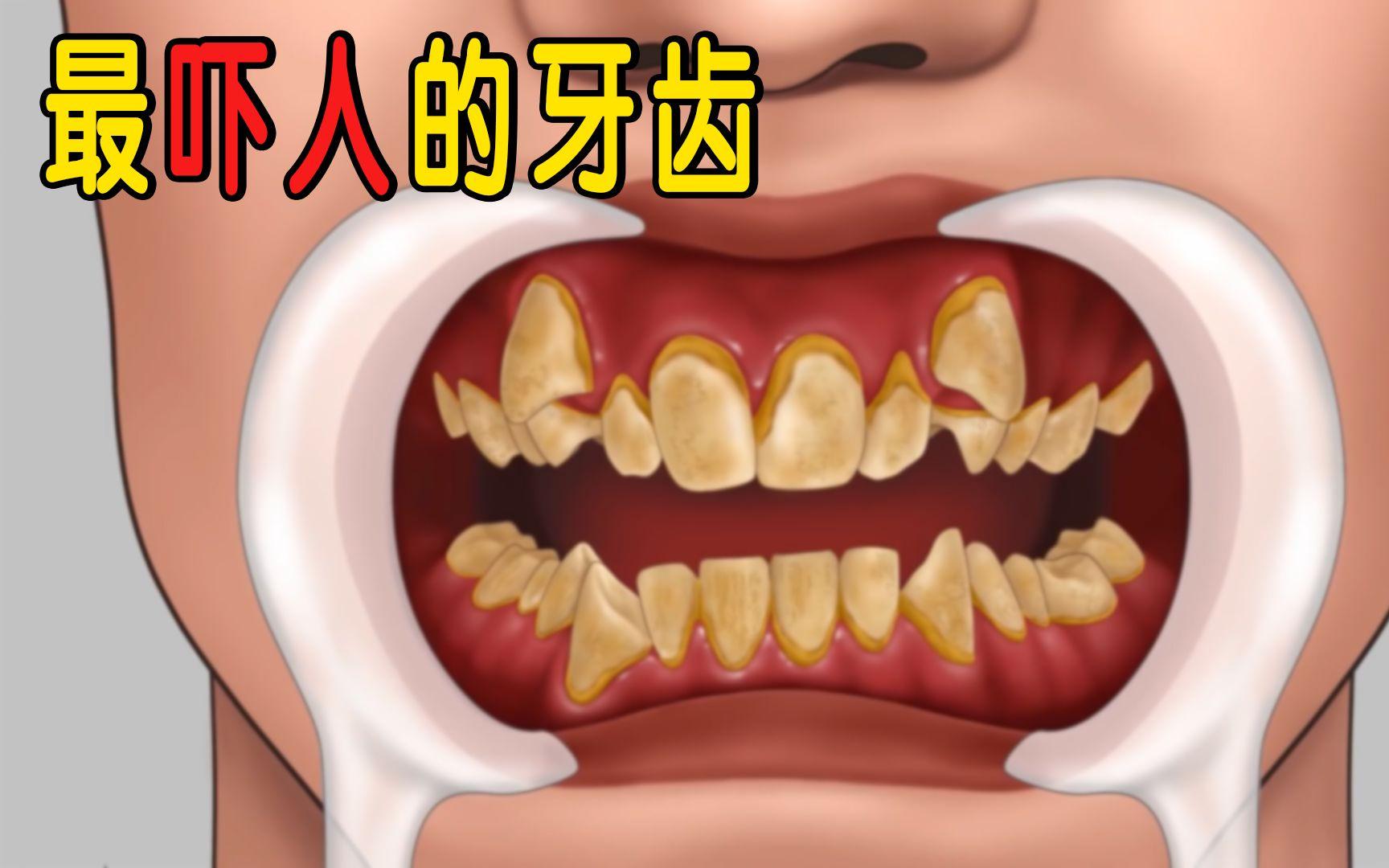 法医秦明里为什么拔掉牙齿(法医秦明为什么不是原班人马)