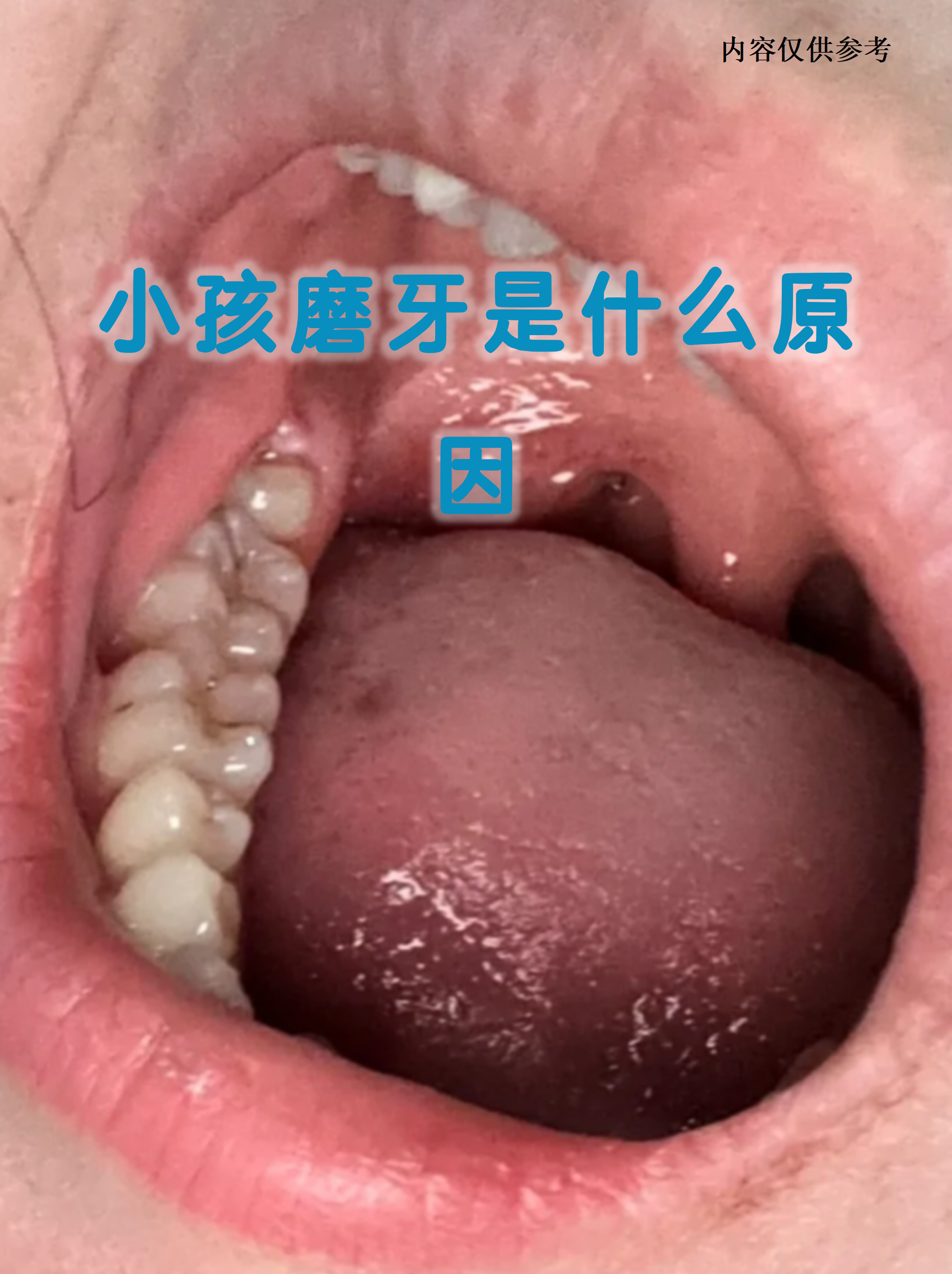咬牙切齿的拼音(咬牙切齿的拼音和意思) 咬牙切齿的拼音(咬牙切齿的拼音和意思)