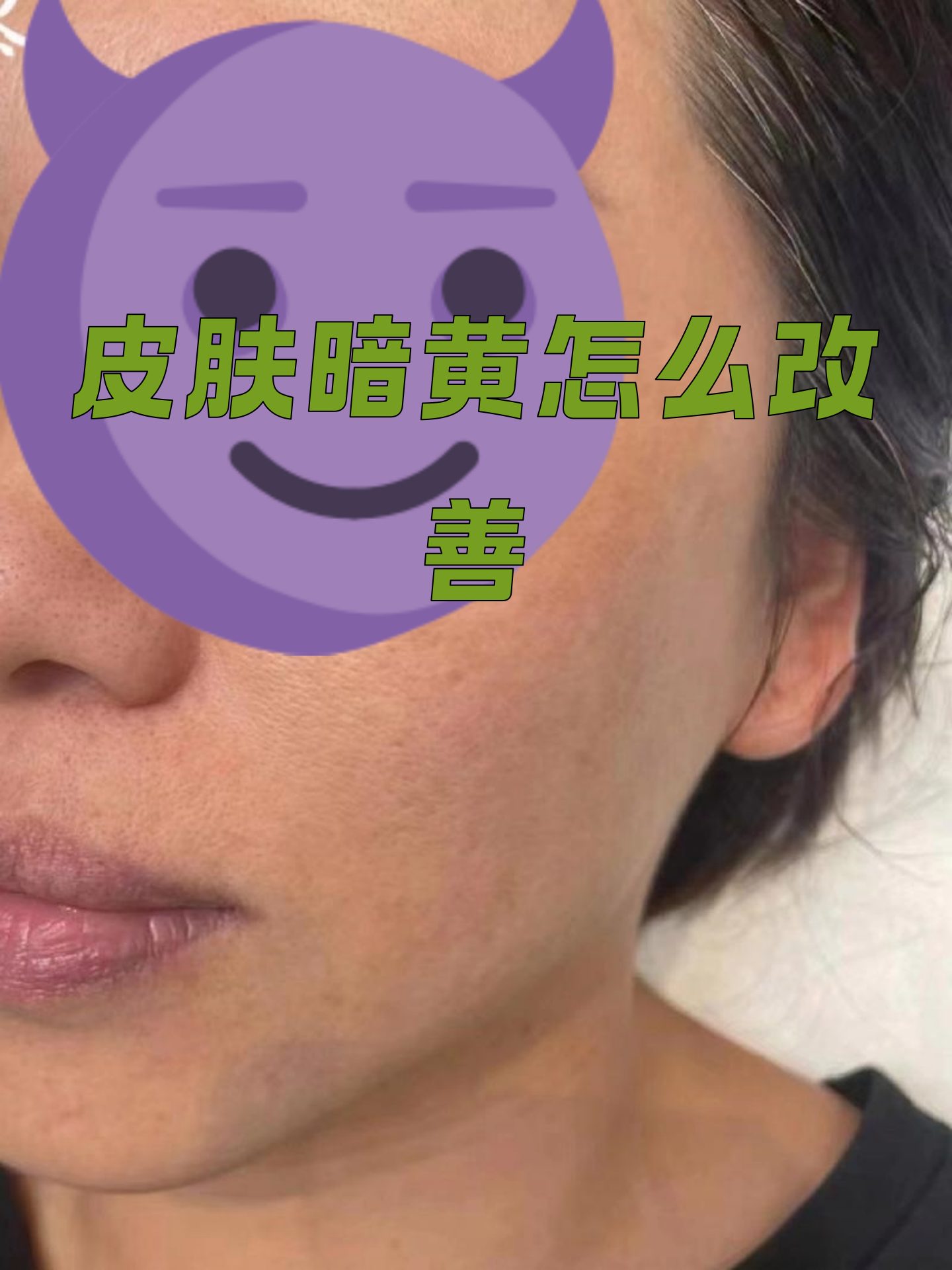脸色黄如何改善(脸色黄该怎么调理)