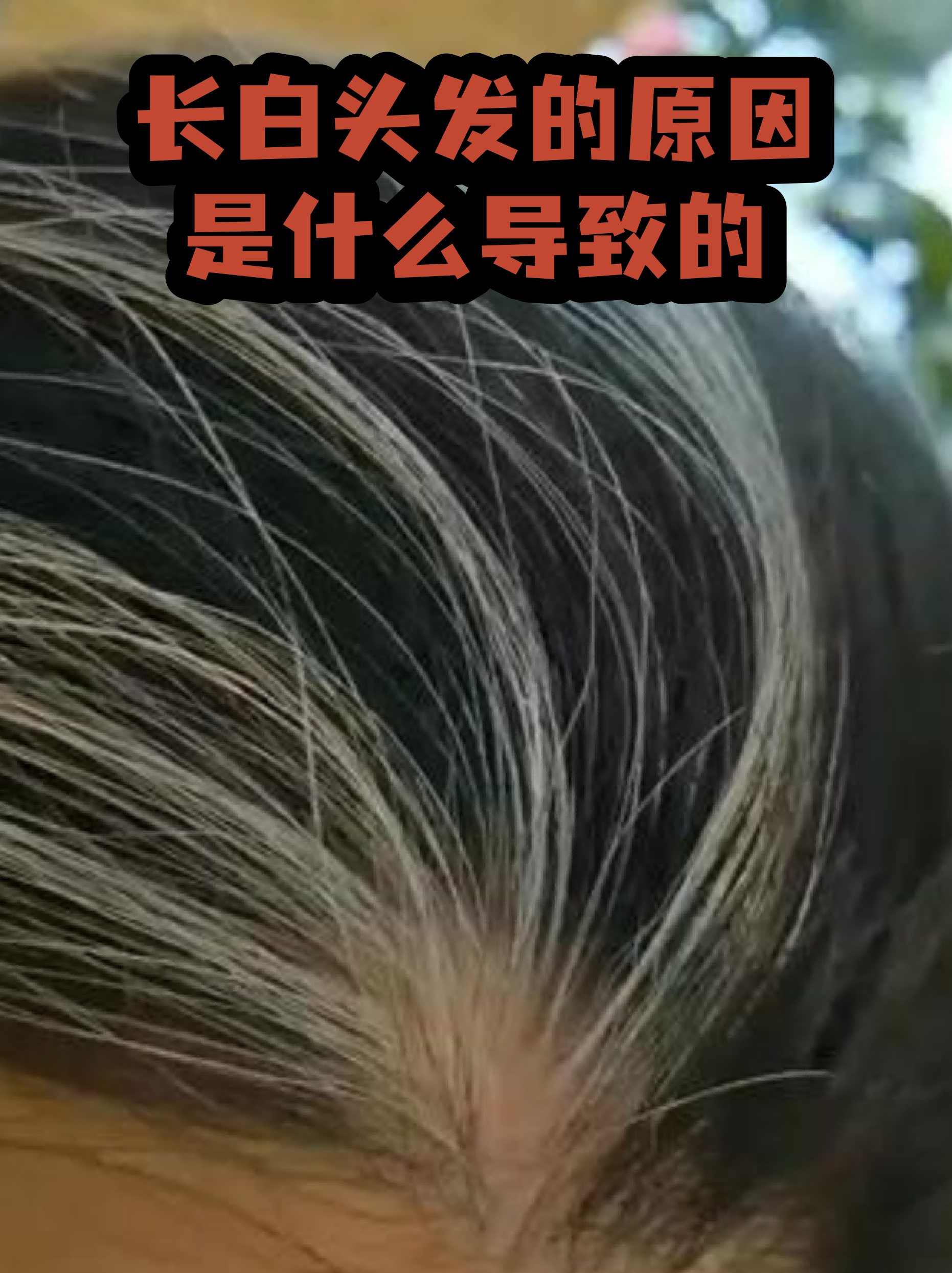 三天头发长10cm的秘诀(头发剪的丑了,怎么快速长头发)