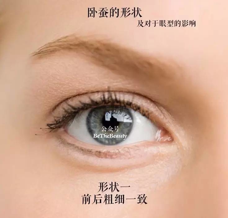 卧蚕是什么意思(眼睛卧蚕是什么意思) 卧蚕是什么意思(眼睛卧蚕是什么意思)