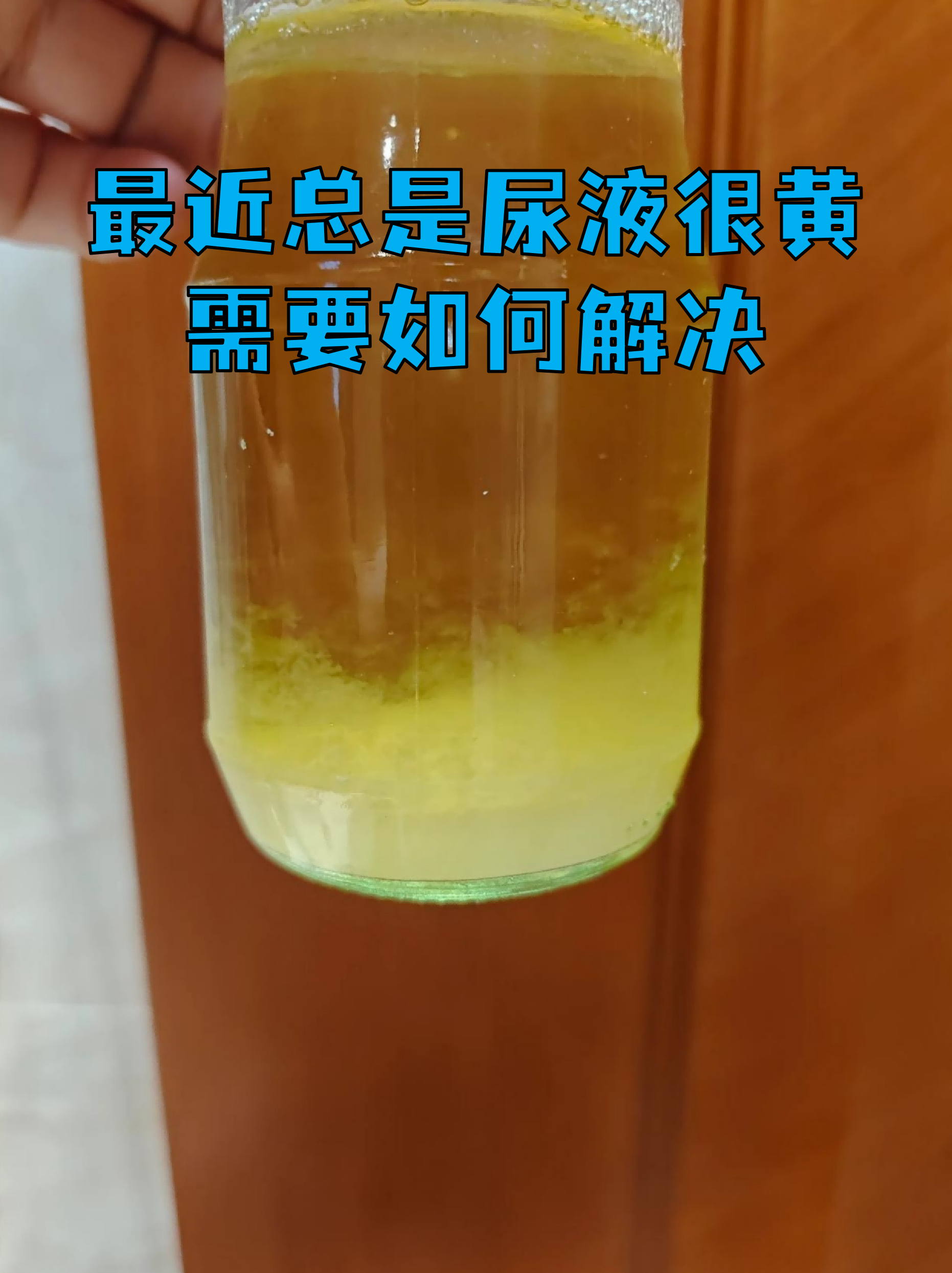 女性最近小便是柠檬黄的颜色(女性最近小便是柠檬黄的颜色正常吗)