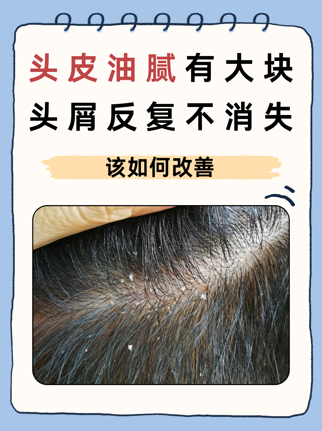 发泥对头发有伤害吗(发胶发泥对头发有伤害吗)