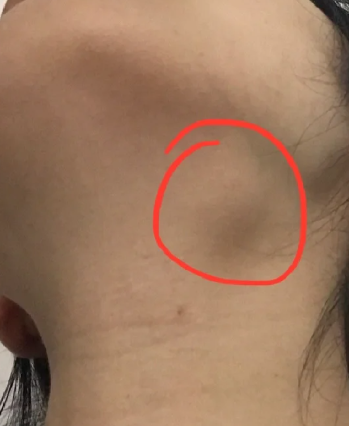 下巴中间有个凹陷是什么原因(下巴中间有个凹陷是什么原因引起的)