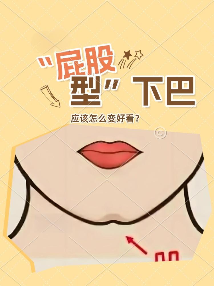 下巴中间有个凹陷是什么原因(下巴中间有个凹陷是什么原因引起的) 下巴中间有个凹陷是什么原因(下巴中间有个凹陷是什么原因引起的)