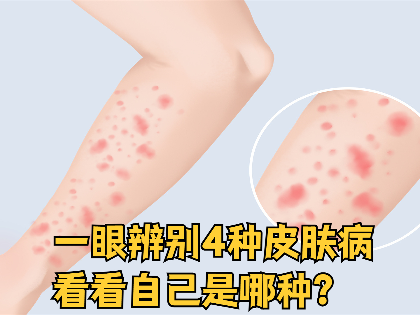 100种皮肤病对照图(100种皮肤病对照图症状及名称)