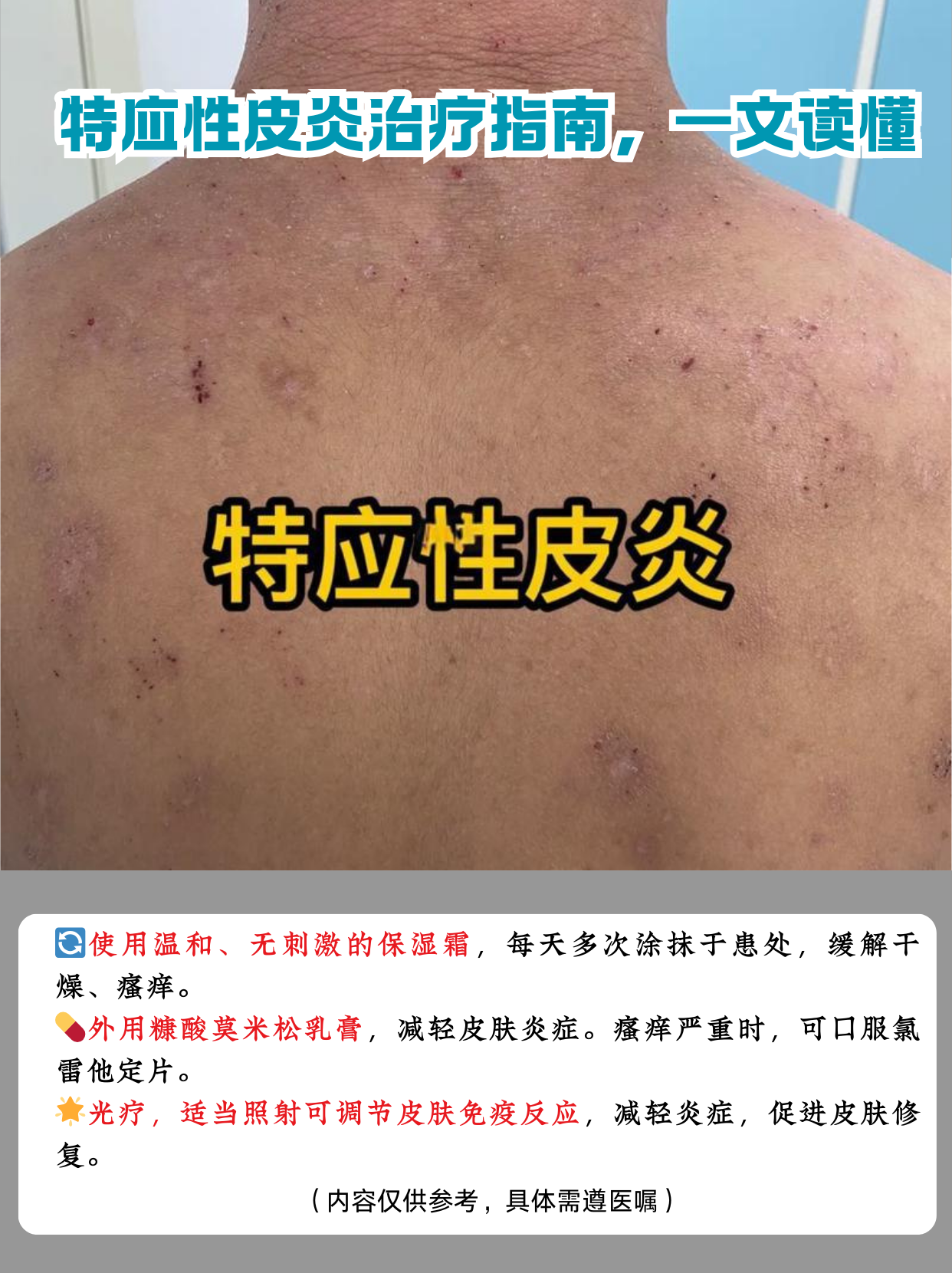 100种皮肤病对照图(100种皮肤病对照图症状及名称)