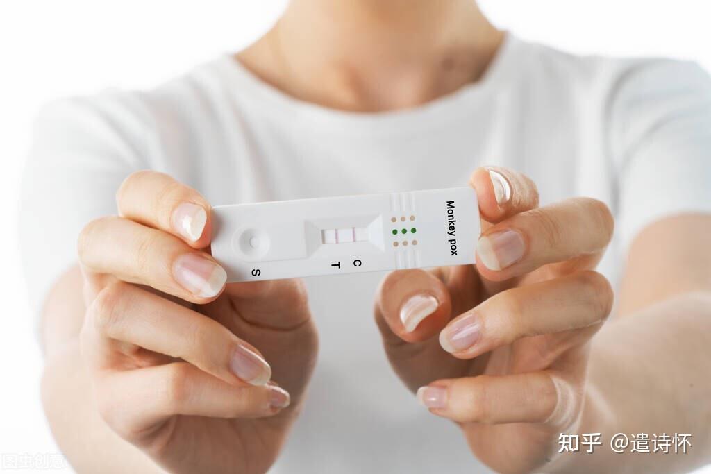 与猴痘有关的股票(猴痘是人畜共患病吗)