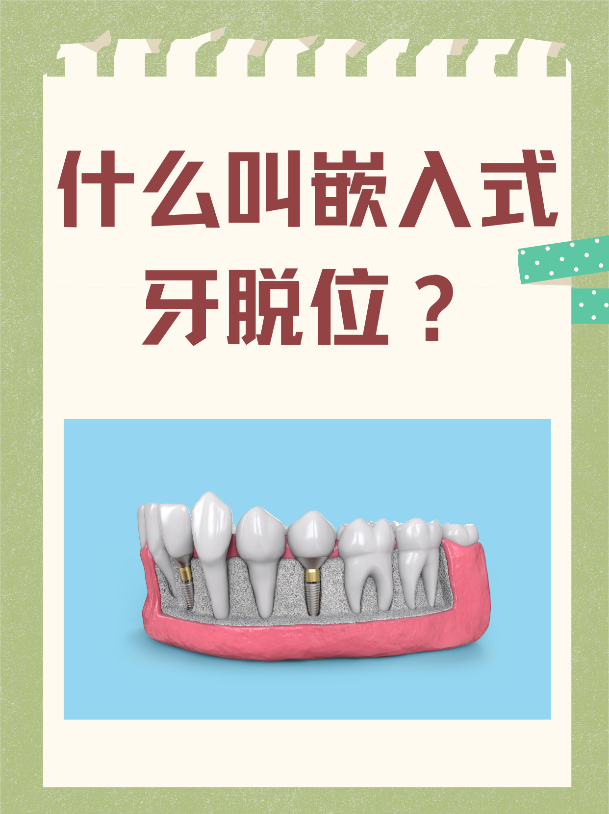 如何让摇晃牙脱落(牙晃动的最快解决方法)