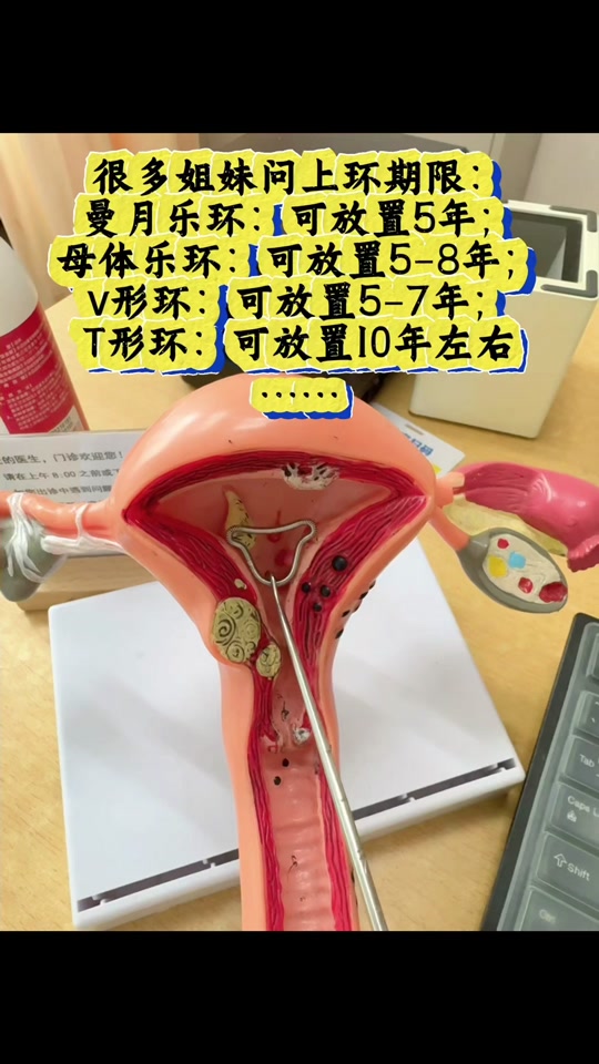 带曼月乐环的好处与坏处(带曼月乐对身体健康有影响吗)