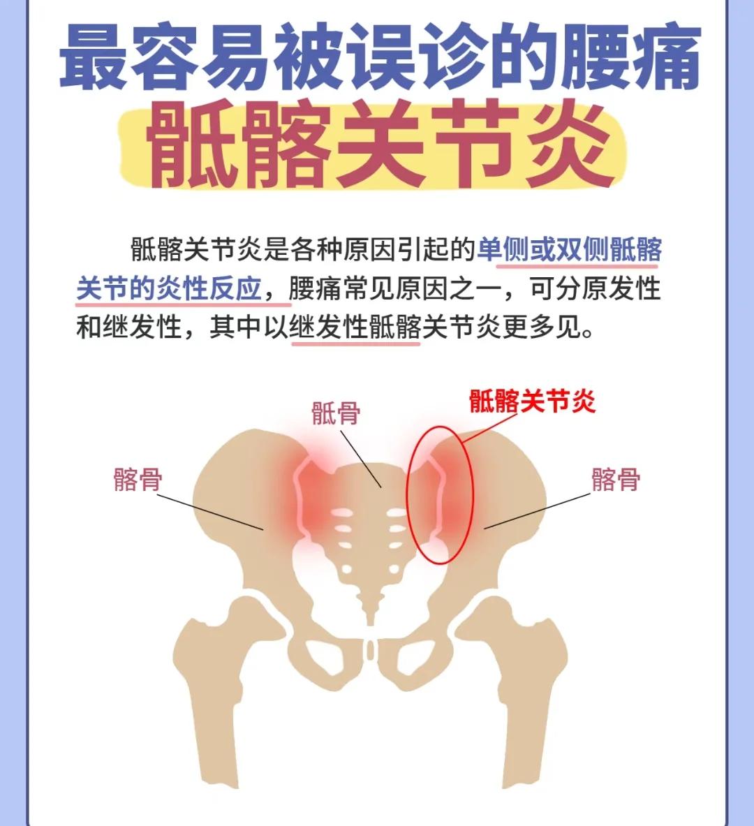 髂怎么读(髂胫束怎么读)