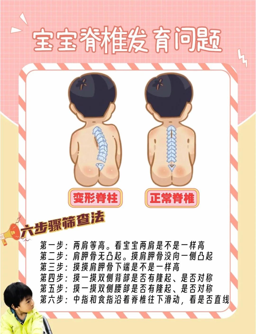 脊的拼音(纤细的拼音) 脊的拼音(纤细的拼音)