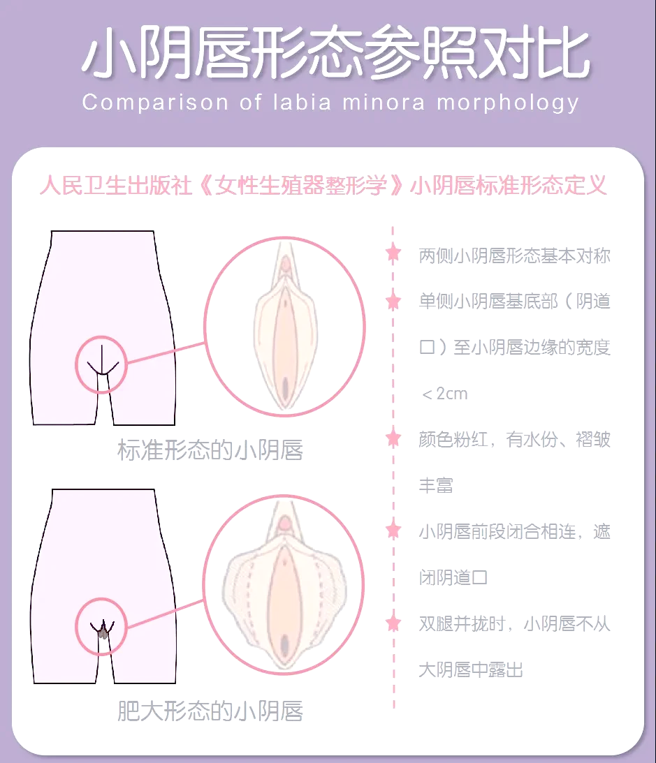 元阴是什么意思(古人说的元阴是什么) 元阴是什么意思(古人说的元阴是什么)