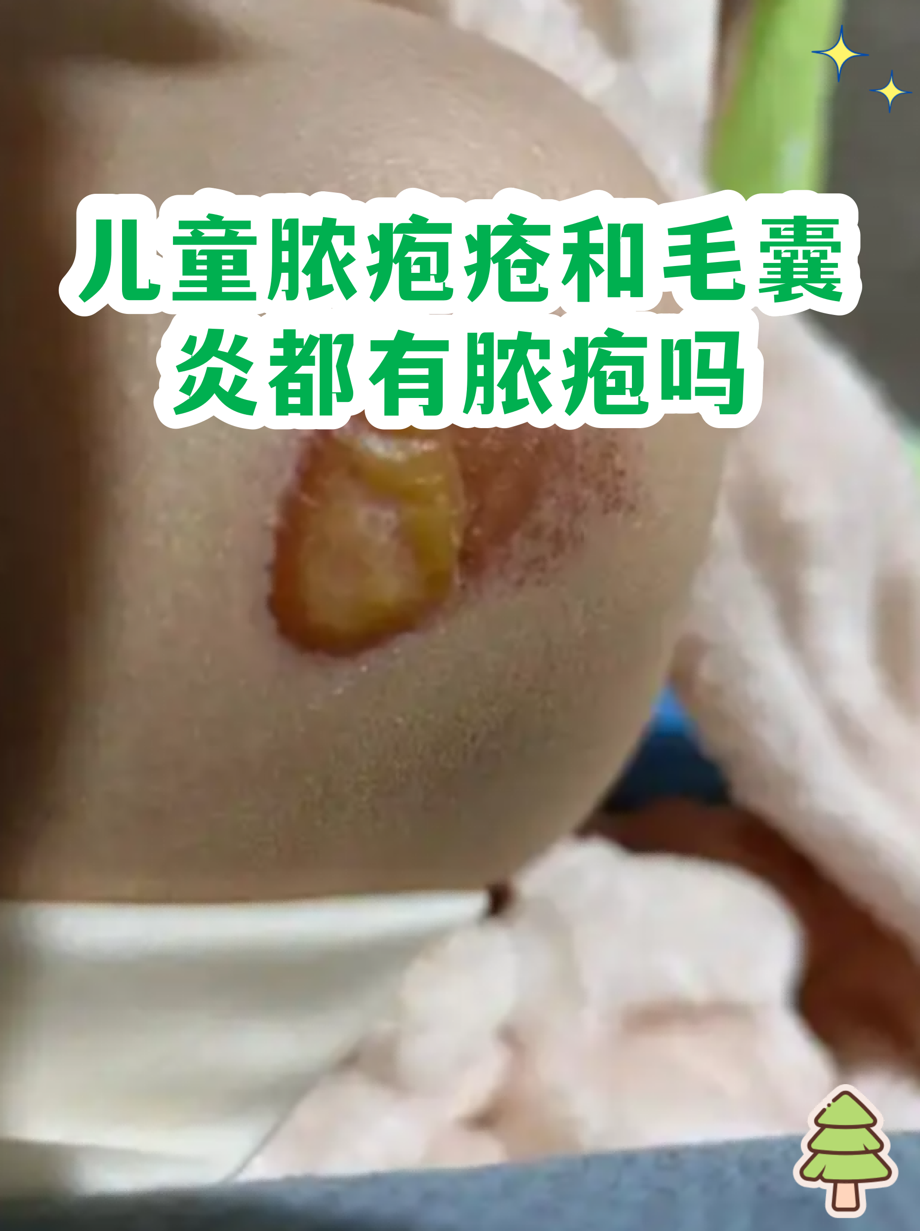 痂怎么读(血嗄痂怎么读) 痂怎么读(血嗄痂怎么读)