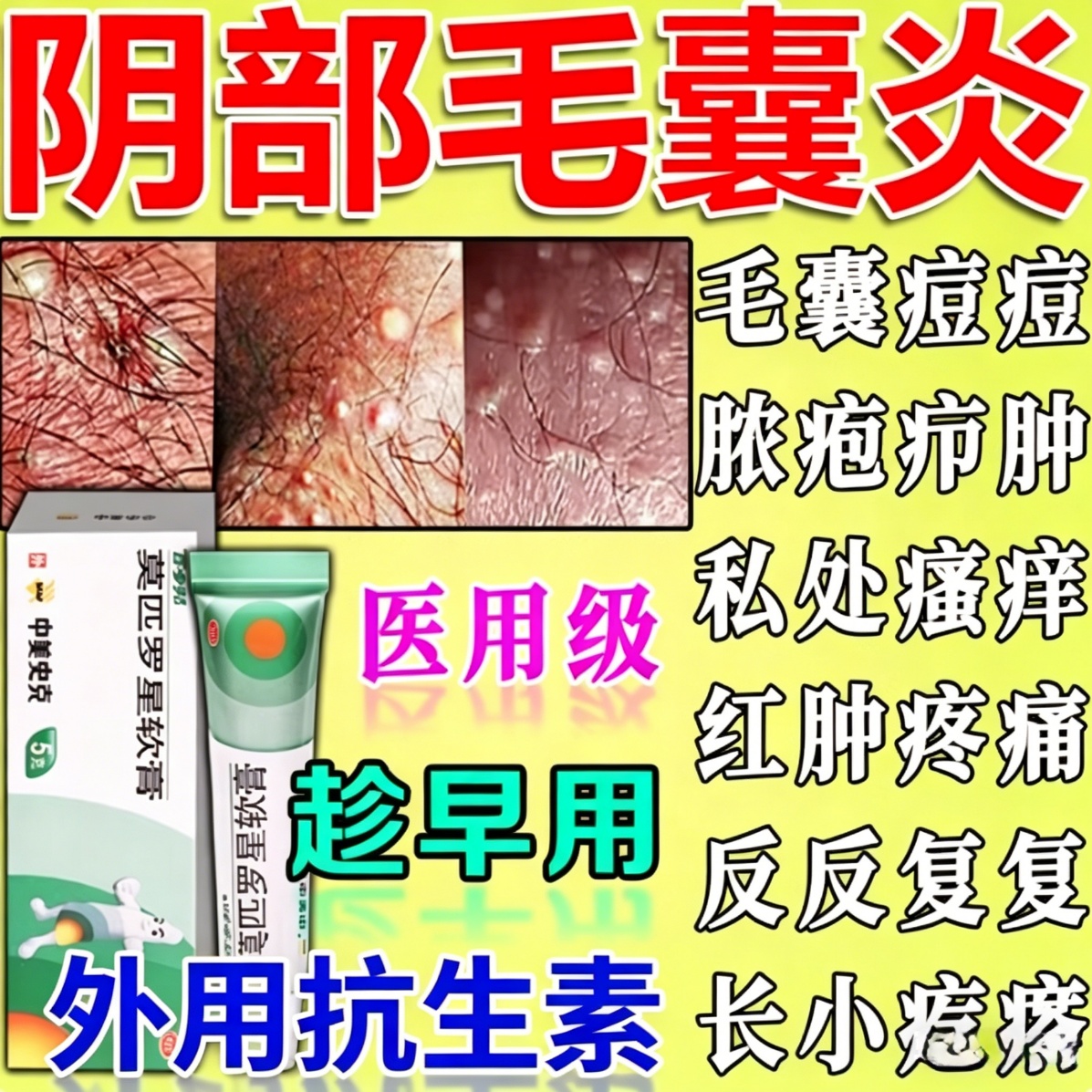红霉素和百多邦哪个好(红霉素和百多邦作用一样吗) 红霉素和百多邦哪个好(红霉素和百多邦作用一样吗)