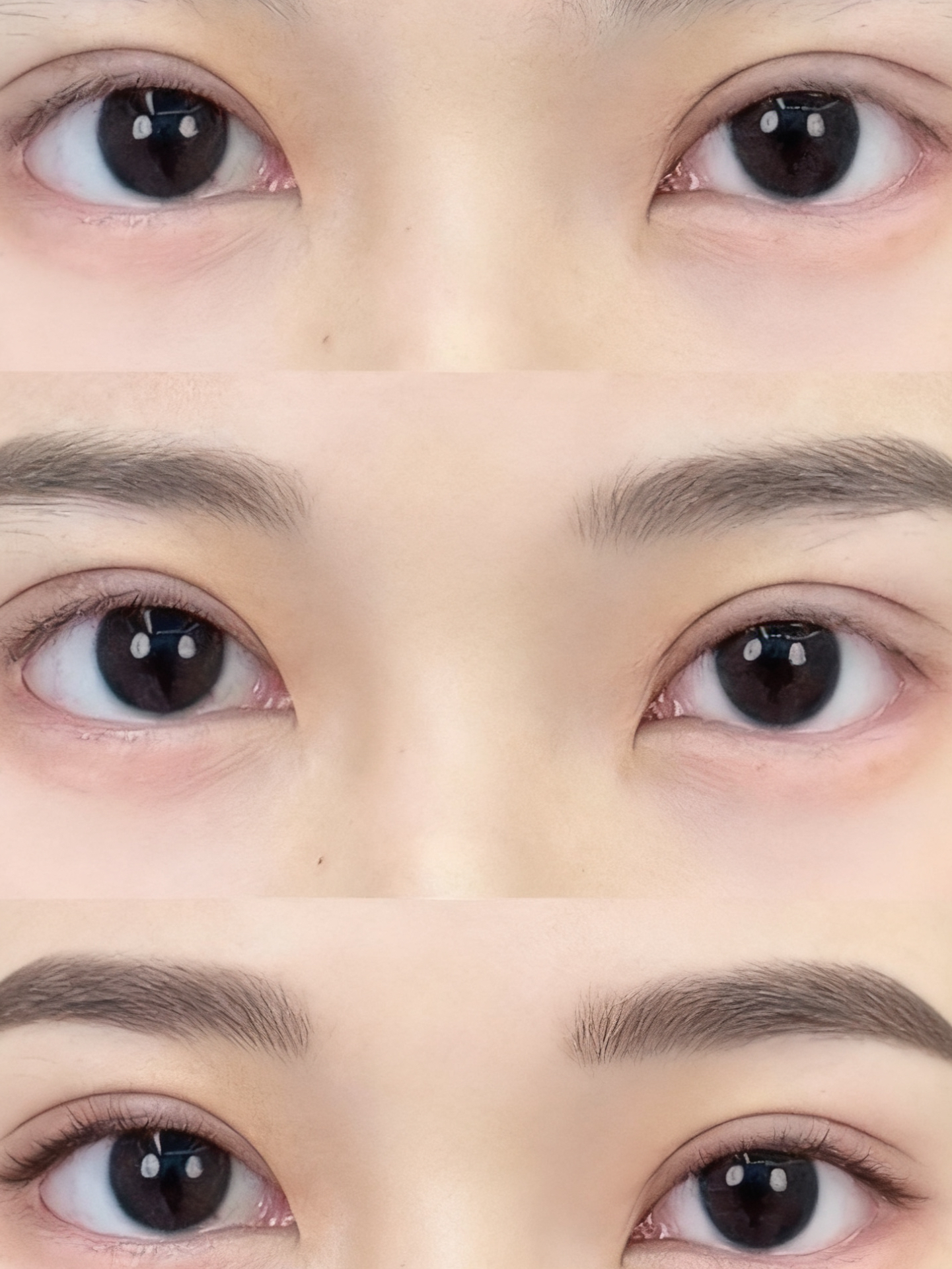 开眼角的好处和坏处(开眼角的好处和坏处有哪些) 开眼角的好处和坏处(开眼角的好处和坏处有哪些)