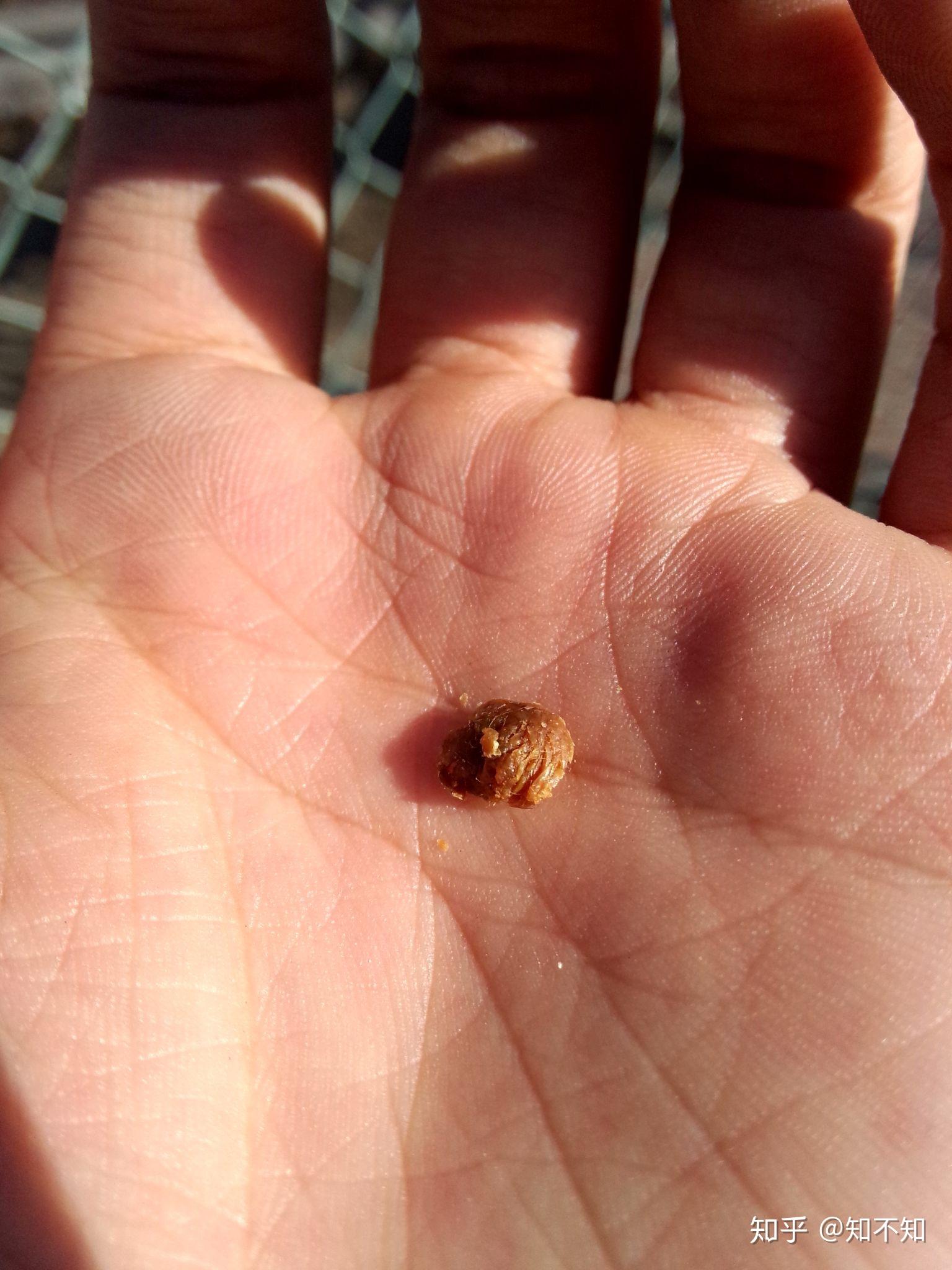 耳屎造句(耳屎还能怎么说)