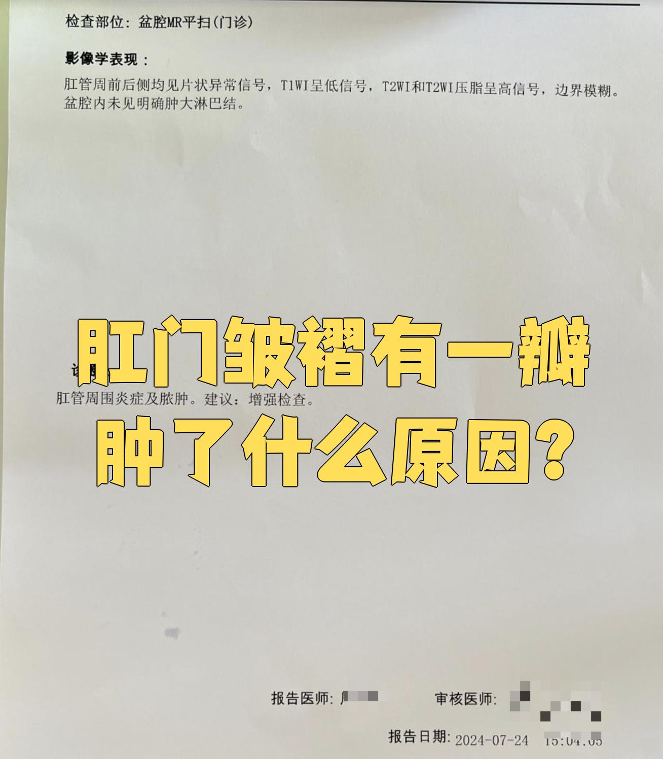 痔的拼音(吮痈舐痔的拼音)