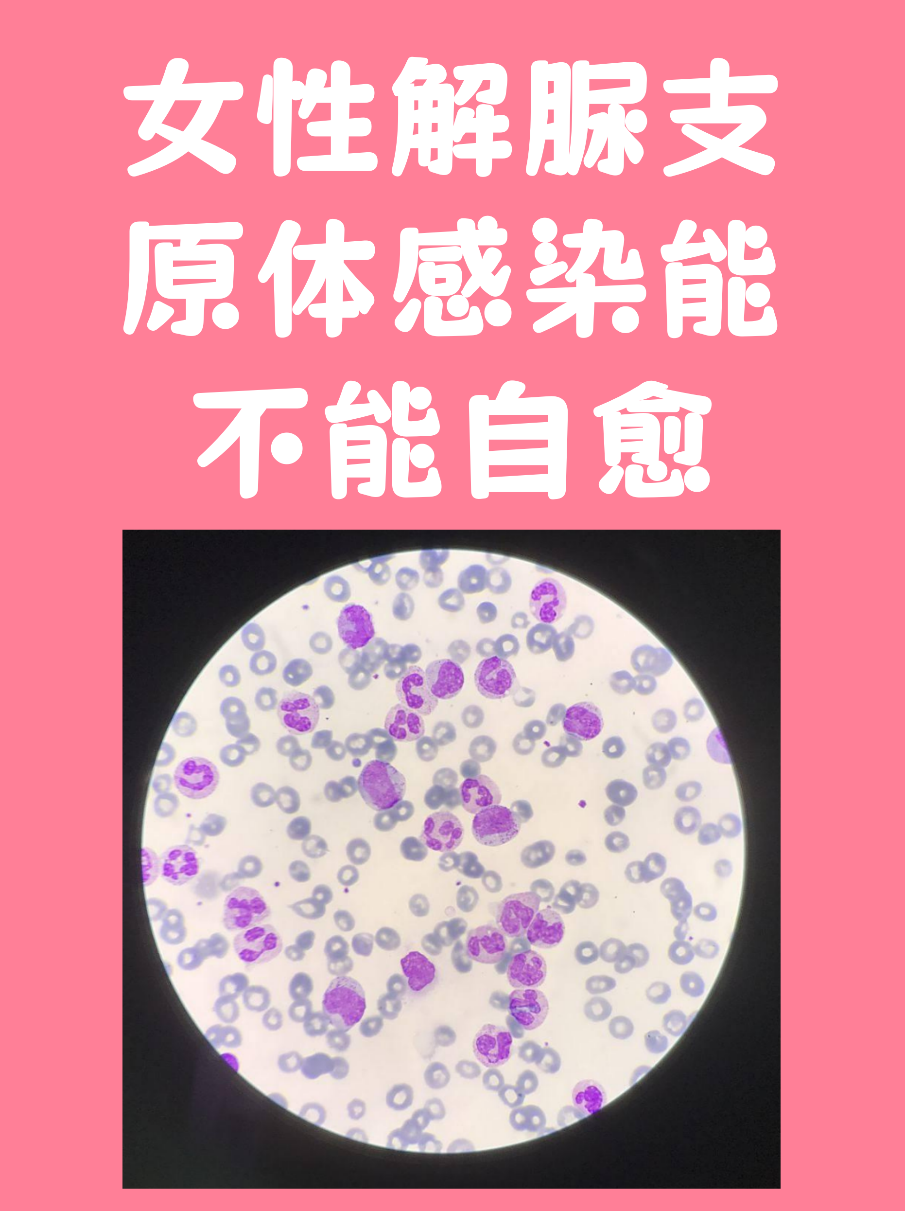 解脲支原体吓了多少人(女性怎么会感染上支原体) 解脲支原体吓了多少人(女性怎么会感染上支原体)
