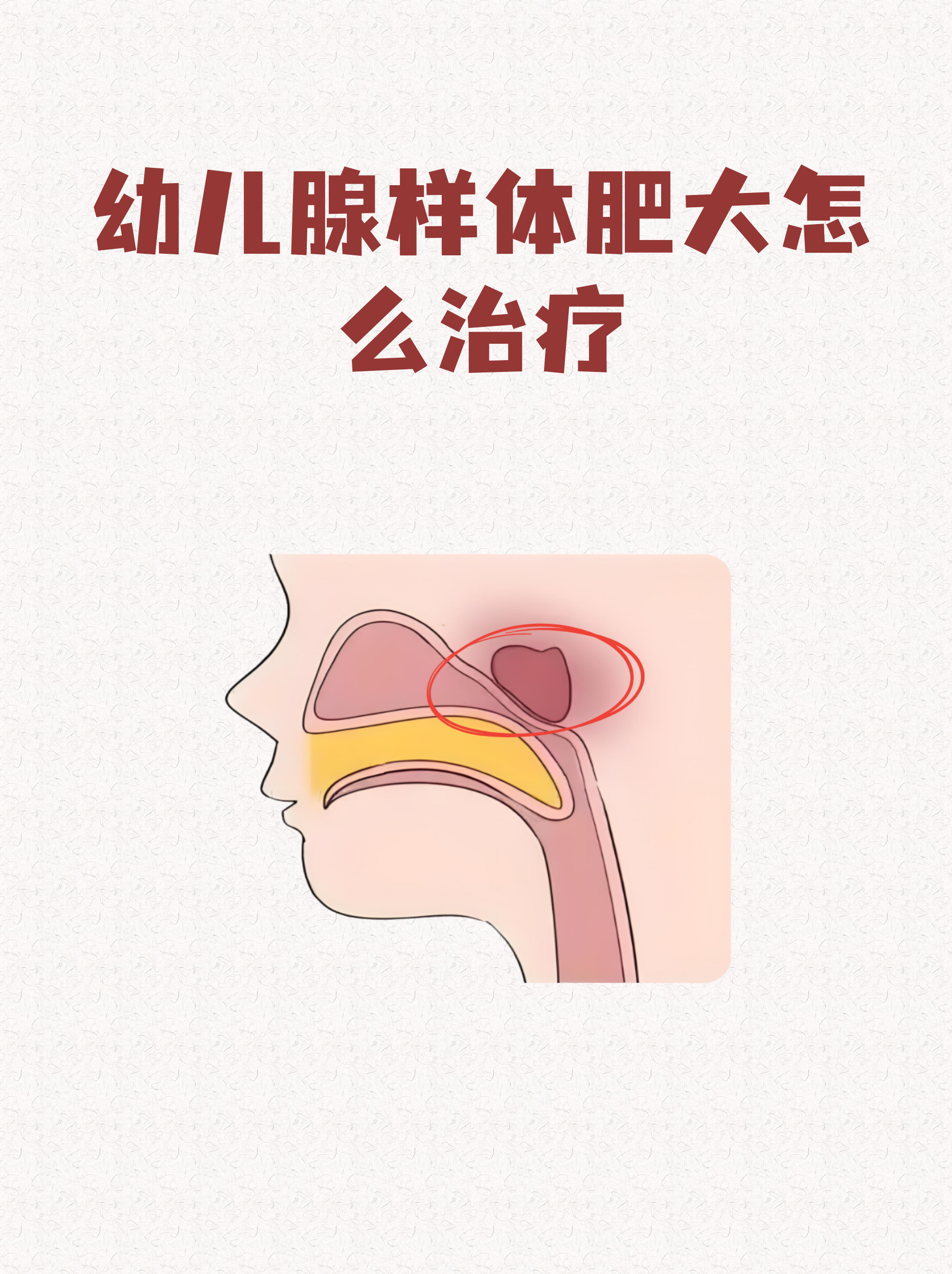 腺的拼音(腺的拼音怎么读)