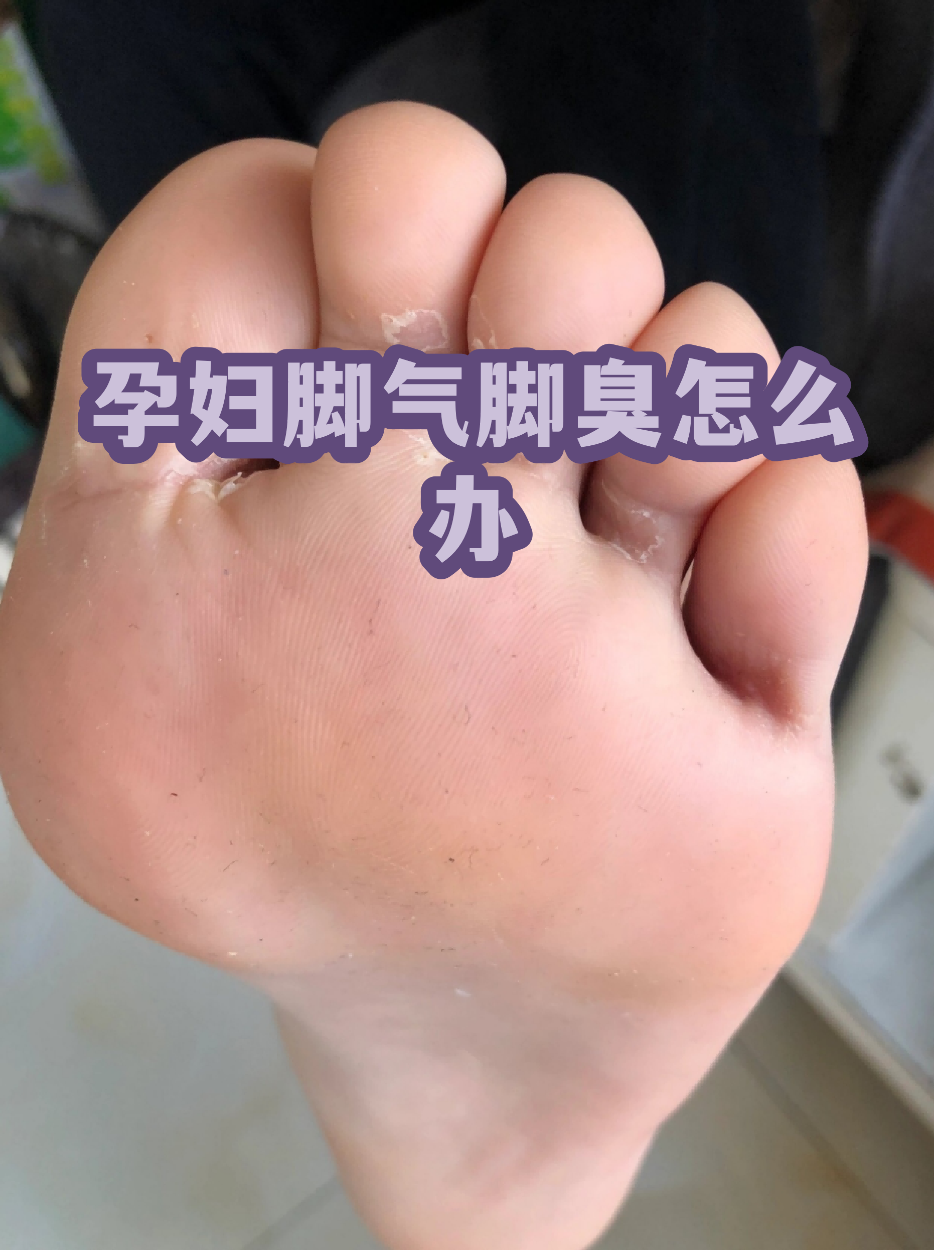 趾怎么读(趾怎么读什么意思)