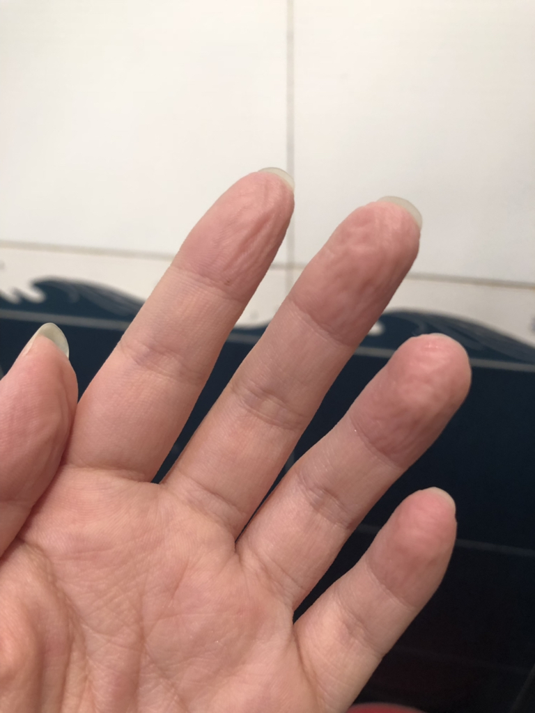 醋酸面料洗了之后皱巴(醋酸面料洗了起皱可以烫吗)
