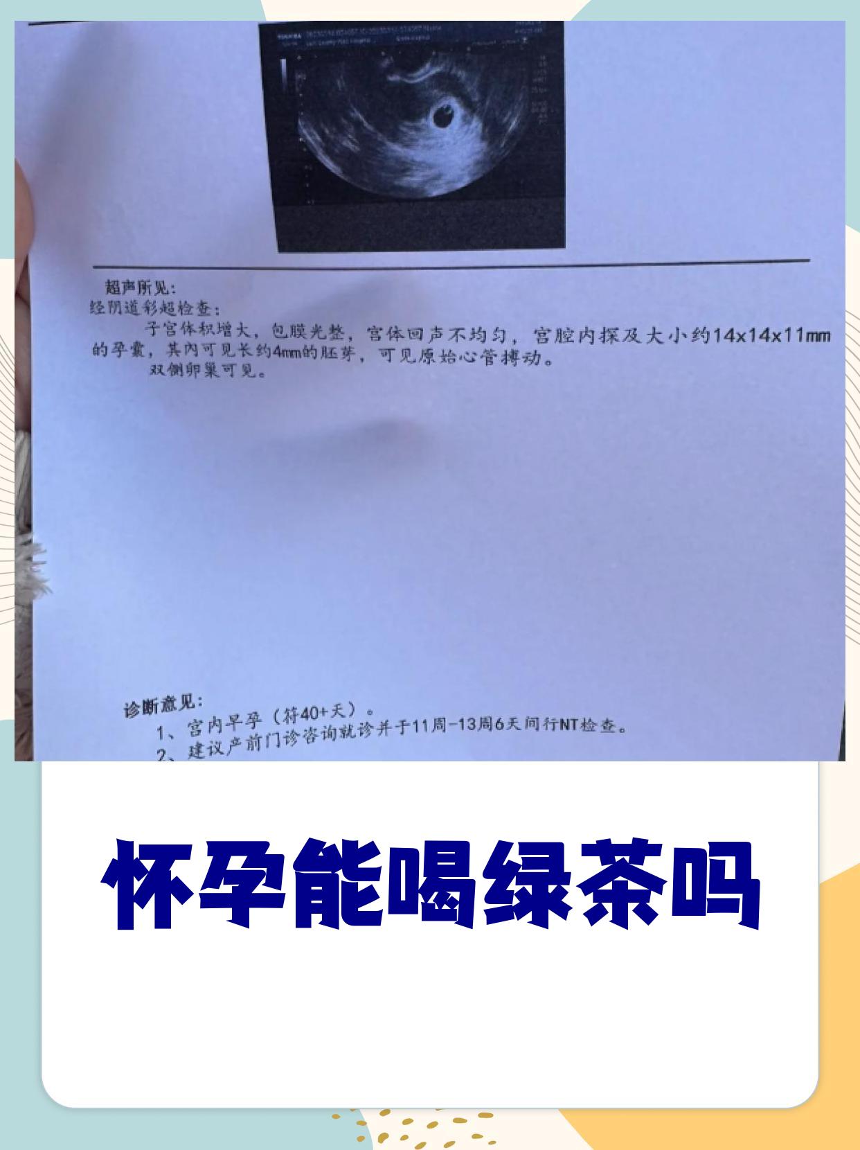 孕妇能喝绿茶不?(孕期可以喝绿茶吗?)