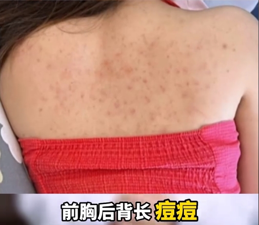 换季身上长了红色的包很痒(换季身上长红疙瘩很痒用什么药)
