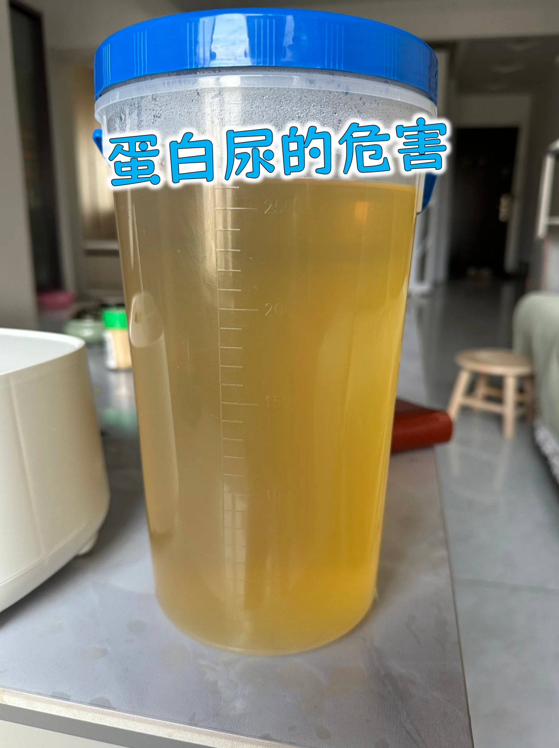 农村治尿蛋白最快土方(治疗尿蛋白的草药有哪些)