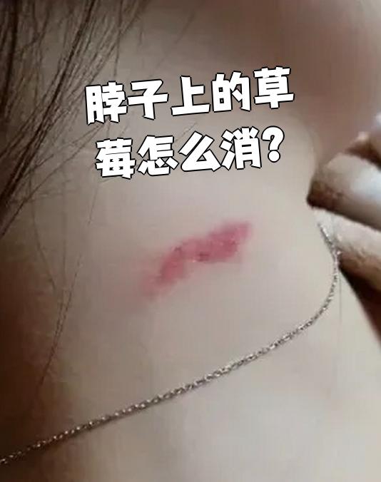 一小时快速消除草莓印(嘴吸的红印怎么5分钟消除)